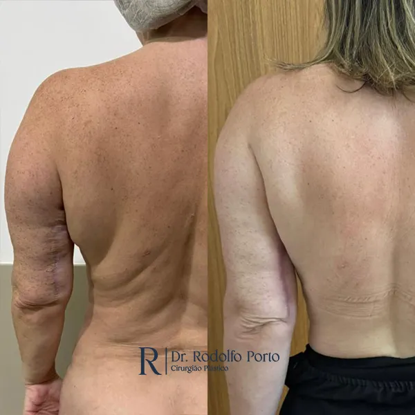 ANTES E DEPOIS 001